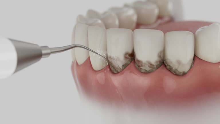 Trusted Teeth Cleaning And Checkup service in Sangaree, SC - Dentist Open Now